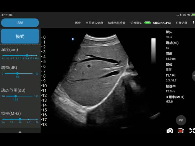 Electronic Convex Array Wireless Ultrasound Device For Mobile Phone