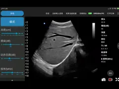 Зонд ультразвука Ipad наркотизации беспроводной для первичной помощи экзаменов POCUS video