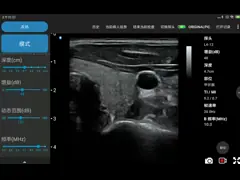 Handheld беспроводной зонд ультразвука 12MHz для на открытом воздухе осмотров video