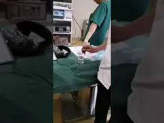 Обработка лазера гольмия оториноларингологии носовых полипов и Papilloma горла video