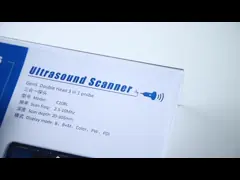 Портативный беспроводной ультразвуковой зонд для iPhone, домашний ультразвуковой сканер video