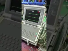 ECG Equipment