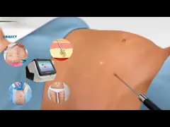 980 нм лазерная липосакционная машина для похудения video