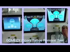 50 кг Q с коммутируемым Nd YAG татуировочным устройством 100-2000J Пиколазерная машина video