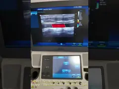 Lineaire de Seriesonde van L14-6wemindray voor gelijkstroom-8 Ultrasone klankmachine