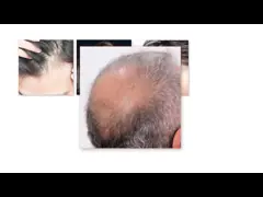 Растительный эффективный спрей для волос, масло для роста волос Противоустойчивое лечение волос video