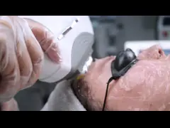 Фотоэпиляция Ipl Удаление волос Машина портативный материал ABS для лечения прыщей video