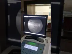 Машина ударной волны высокой точности внекорпусная, система Шокваве Литхорипсы кс Рэй video