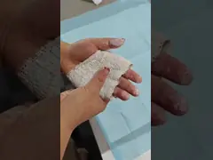 Медицинский ПОП Ортопедический литой повязка одноразовый ПОП повязка гипс из пар Поп повязка video