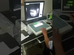 X-ray automatic system