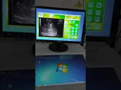 Фиксированный ультразвук машины Литхотрипсы ударной волны источника волны внекорпусный обнаруживая местонахождение систему video