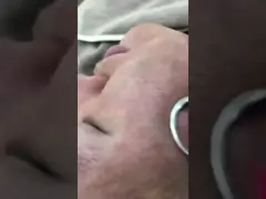 Система обработки углекислого газа Лазерное оборудование для постоянного удаления шрамов video