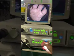 VP-4450HD+XL-4450 Endoscopy Processor Medical High Image Quality