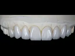 Tùy chỉnh Phòng thí nghiệm nha khoa Laminate veneers với độ bền và độ bền cao