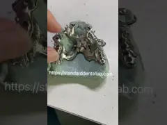 CAD CAM Металлическая рамка для съемного частичного протеза 3Shape Exocad video