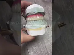 Высококачественная зубная цирконовая корона и All On Four Six Implant Full Arch / Китайская стоматологическая лаборатория video