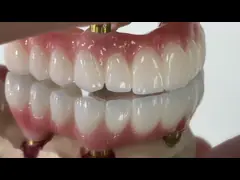 Dental Todo sobre X Implante PFM Corona Titanio Fijación de la prótesis híbrida video
