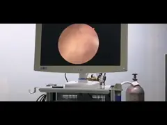 Электрод урологии системы хирургии плазмы RF для доброкачественной простатической гиперплазии video