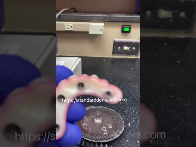 歯科の高度な精度