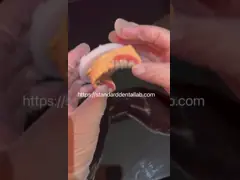 OEM Standard Dental Lab Full Removable Dentures Easy To Take In And Out video