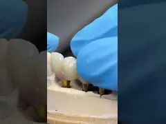 Порцелановый циркониевый цемент с задержанным винтовым имплантатом Шестиугольная форма головы для индивидуальной эстетики video