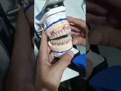 Все на четыре шесть Ивоклара Циркония Имплантат Мост Титановый Стержень С Розовой Порцеляной video