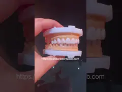 Зубные короны диагностический вакс-up высокая эстетика из китайской стоматологической лаборатории video