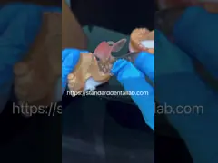 Clear framework Acrylic Metal Partial Denture Frameworks High Esthetics China dental lab