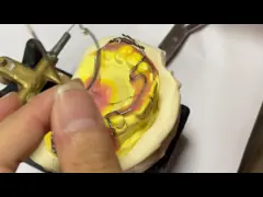 Удаляемый расширитель для эффективного ортодонтического лечения и улучшения улыбки video