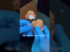 Removable Clear Acrylic Partial Denture Clasps Retentive Natural Looking