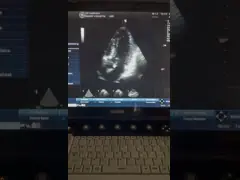 GE VIVIDS6 phased array original ultrasound transducer probe 3S-RS