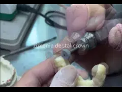 Aesthetic Natural Looking Full Zirconia Crown , Dental Crown Material Zirconia