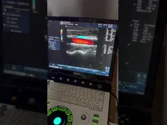 Оригинальная портативная ультразвуковая сканирующая машина, GE Logiq E медицинское УЗИ оборудование video