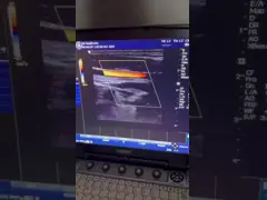 Оригинальное ультразвуковое оборудование GE портативная ультразвуковая машина Logiq E video