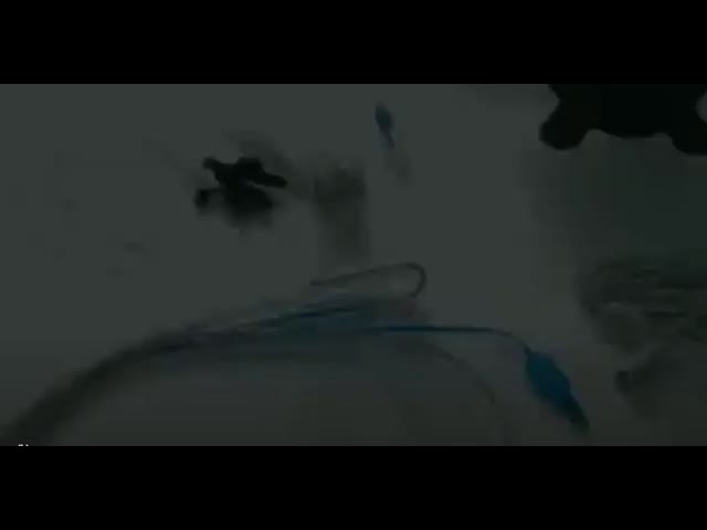 ПВХ одноразовая визуальное наручники усиленный всасывающий эндотрахеальная трубка с миниатюрной камерой видео