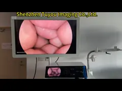 220V TUYOU Endoscopia Chirurgia LED Fonte di luce fredda medica con intensità regolabile e cavo in fibra ottica per endoscopi
