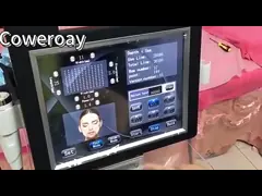 Ультразвуковой аппарат высокой интенсивности для омолаживания кожи video