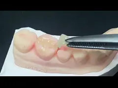 Гипоаллергенный, устойчивый к пятнам керамический инлей Emax для точного восстановления поврежденных зубов video