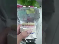 Implants dentaires durables avec une coque en titane facile à nettoyer et une couronne en zirconium