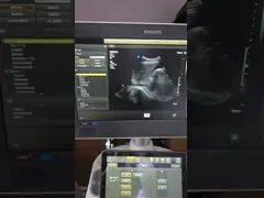 ATL CX50 EPIQ Curved Array Original Ultrasound Probe C5-1 For OB/GYN