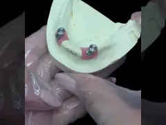 China Removable Denture with HPP Frame and Acrylic Base for Enhanced Durability and Comfort supplier