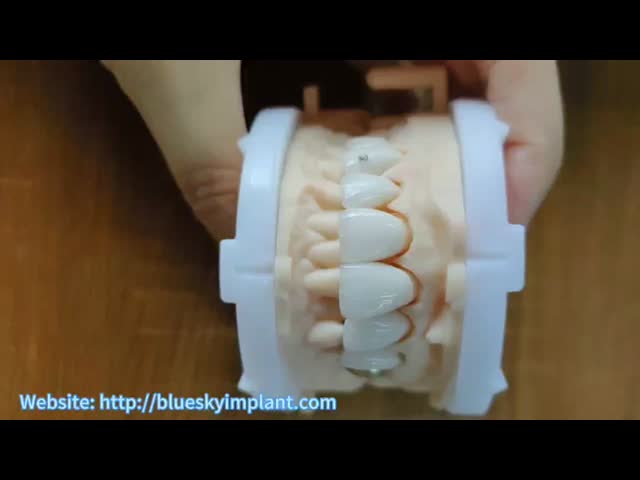 Highly Translucent Zirconia Crowns Bridge Veneers With Customized Jewelry And Gold Beautiful Dental Restoration Case