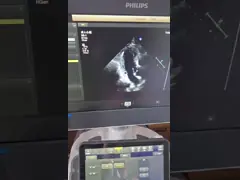 ATL Affiniti7 EPIQ Orignal Phased Array Ultrasound Probe S5-1 For Cardiac