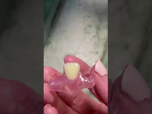 ネズビテ の 柔軟 な 義歯 は,快適 な 笑顔 を 作り出す ため の 絶妙 な 解決策 です