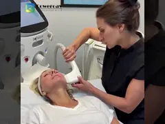 7D Wrinkle Removal RF Ultrasound RF Improve Loose Skin Facial Lift Firming Machine