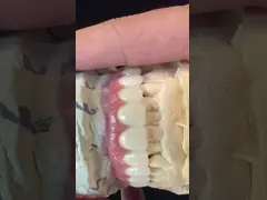 Hybrid Titanium Screw Retained Dental Implant Crown All On 4 Dental Implant Zirconia Bridge