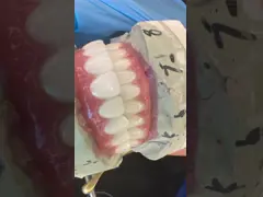 High Quality Dental zirconia crown and All On Four Six Implant Full Arch / China dental lab Manufacturer