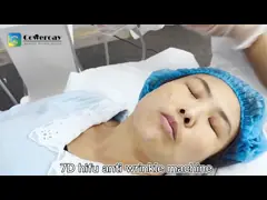 12D Hifu Face Lifting Anti-Wrinkle Skin Tightening Machine For Face And Body