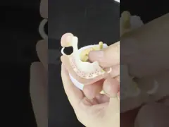 Peek Partial Framework Design ISO CE And FDA Dental Lab Acrylic Partial Denture Framework