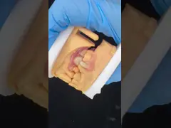 Dental TCS Valplast Flexible Partial Dentures Dental Lab 3D Print Model High Esthetics